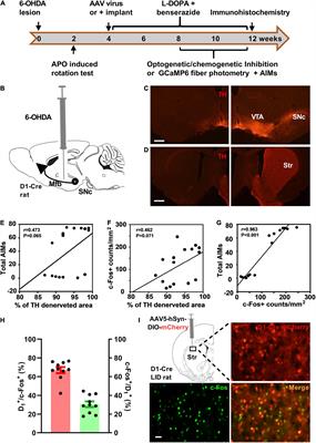 Striatal D1 Dopamine Neuronal Population Dynamics in a Rat Model of Levodopa-Induced Dyskinesia